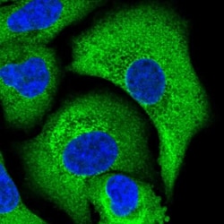 Calpastatin Antibody, Novus Biologicals 0.1mL; Unlabeled:Antibodies, Polyclonal